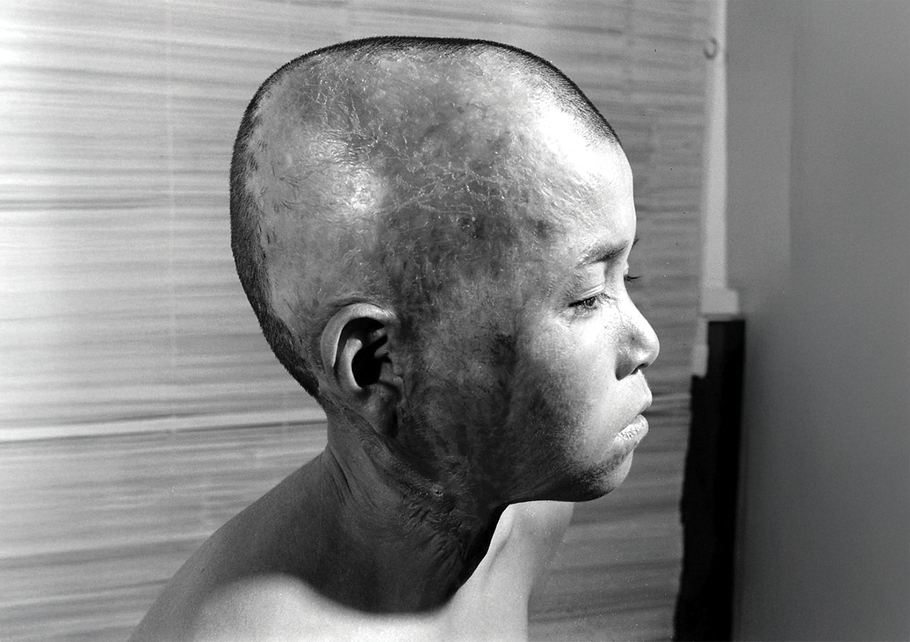 Hiroshima-atomic-bomb-1945